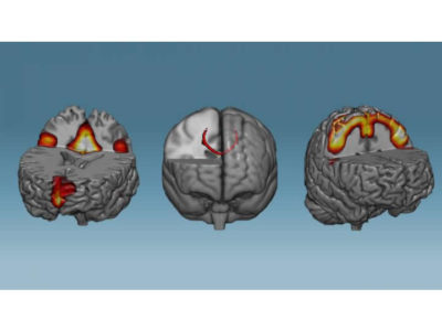 Train your brain, change your brain